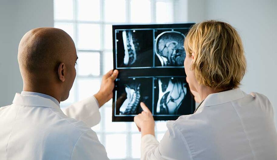diagnose van cervicale osteochondrose door afbeeldingen