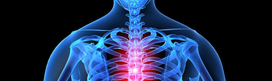 Osteochondrose van de thoracale wervelkolom