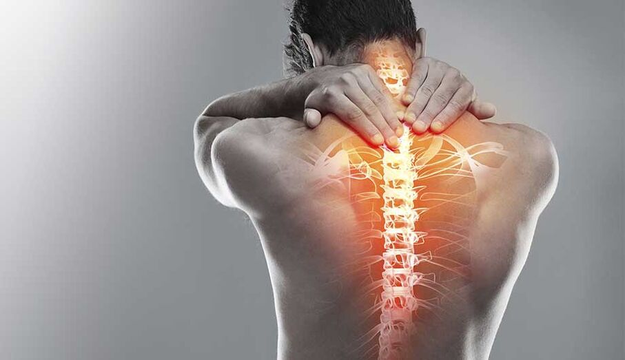 Osteochondrose van de nek
