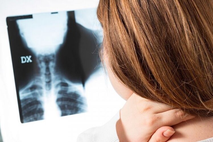 X -Ray van de cervicale regio