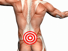 Symptomen en behandeling van lumbale osteochondrose