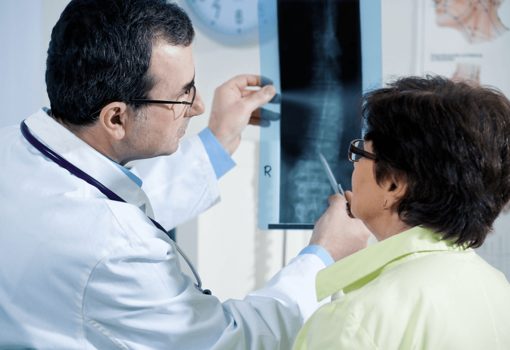 Een neuroloog diagnosticeert osteochondrose met behulp van radiografie van de wervelkolom